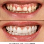 色AV永久无码AV影院 m6yek0